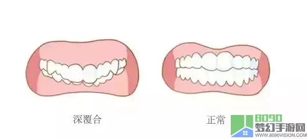 以撒的结合罗盖蘑菇 撒盖蘑菇攻略分享