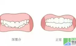 以撒的结合罗盖蘑菇 撒盖蘑菇攻略分享