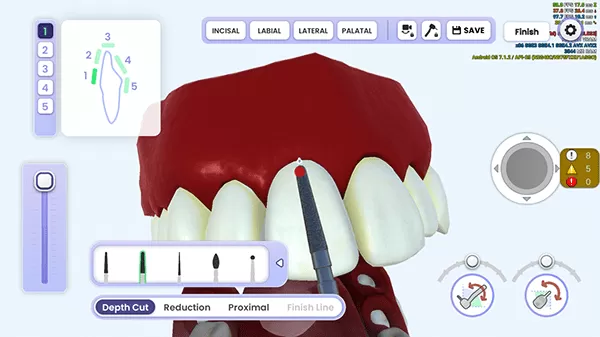 牙医模拟器(Dentist Simulation)游戏免费下载